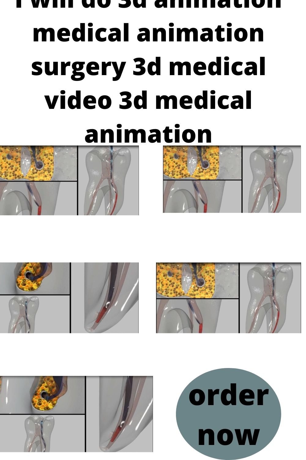 I will do 3d animation medical animation surgery 3d medical video 3d  medical animation - FiverrBox